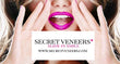 Secret Veneers