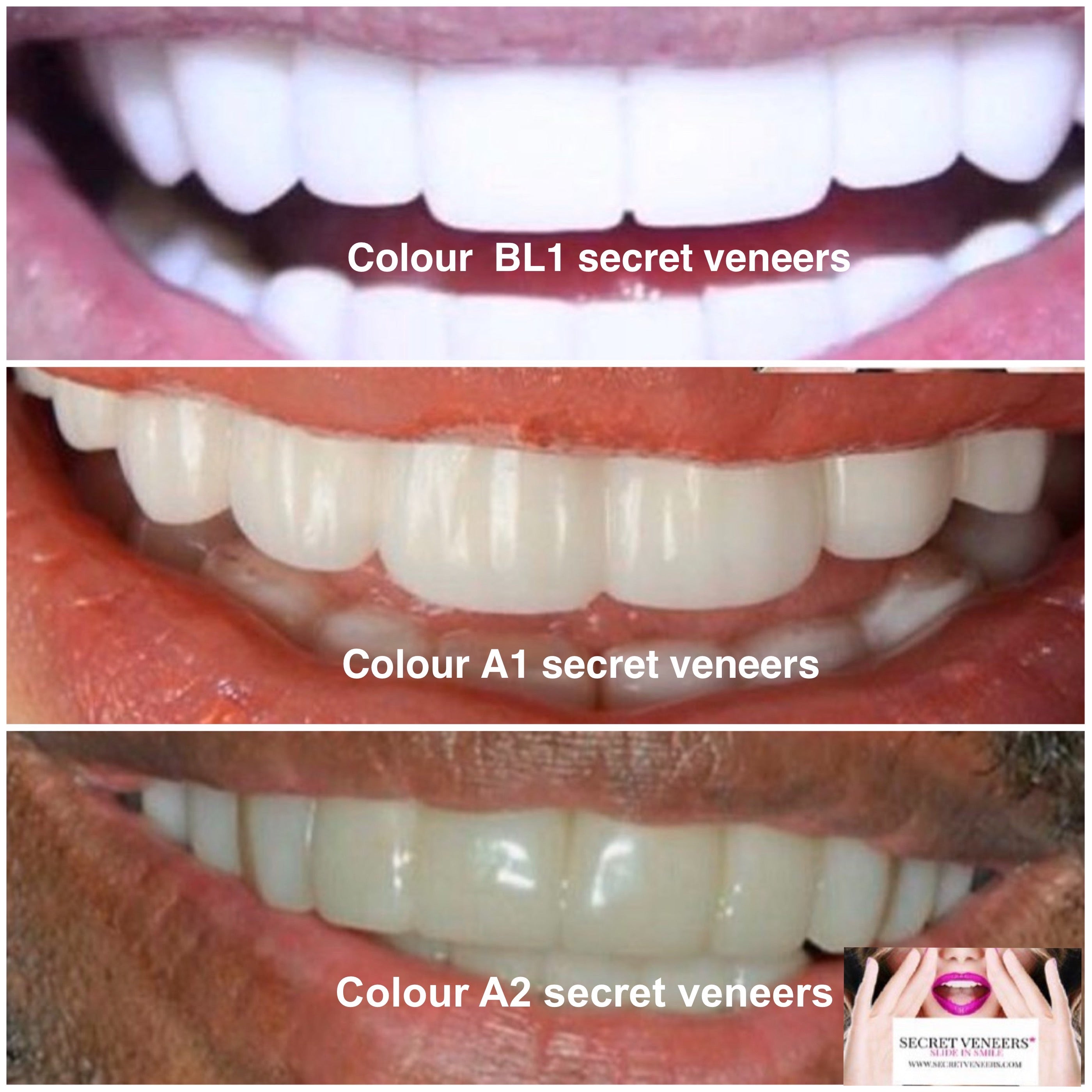 Secret Smile Teeth